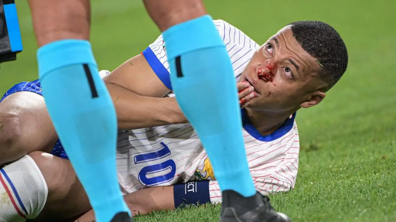 Kylian Mbappe to play in mask at Euros after France star sustains broken nose 1 France forward Kylian Mbappe
