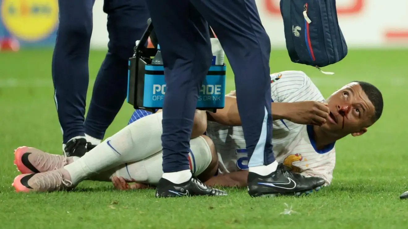 Kylian Mbappe receives treatment for a gone beyond nose