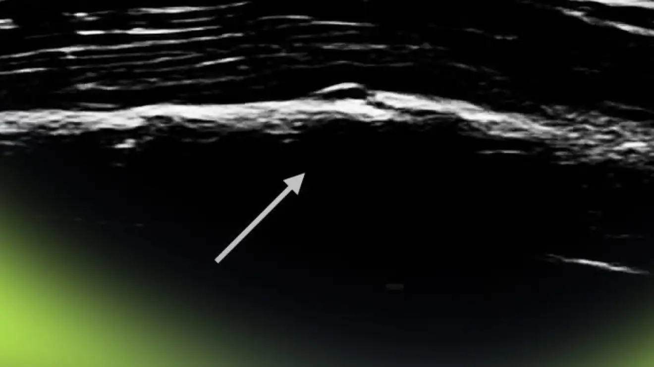 Oscar Piastri shares surprise F1 2024 injury with X-ray image revealed