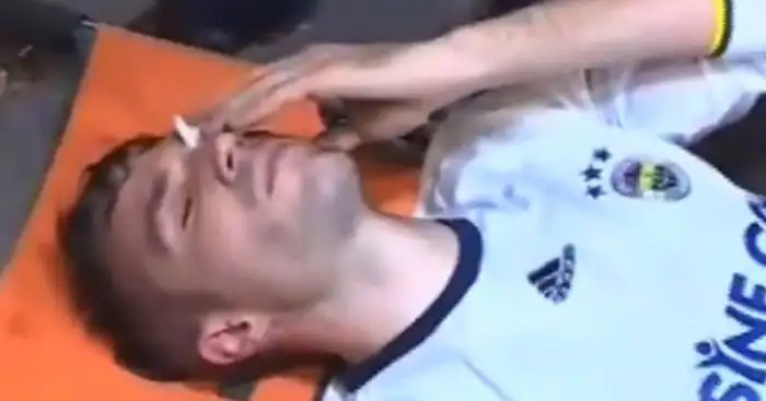 Van Persie posts encouraging update on nasty eye injury