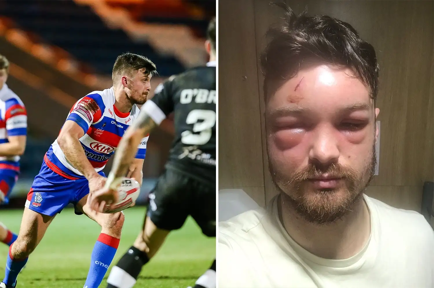 Rochdale star Lewis Palfrey in hospital over serious infection